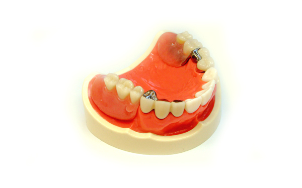 �A�^�b�`�����g�̐����`���E�����s�`�斃�z�\��