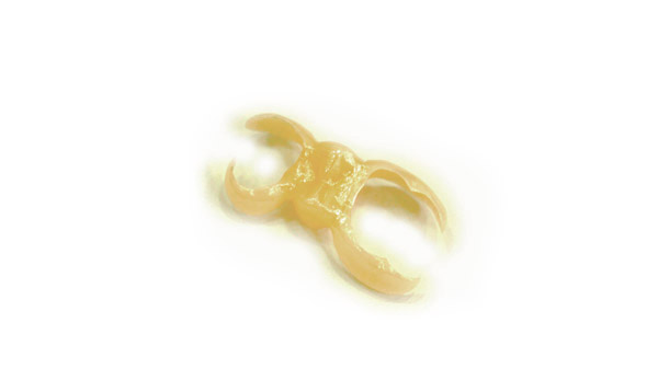 接着ブリッジのセラミックタイプ・東京都港区麻布十番